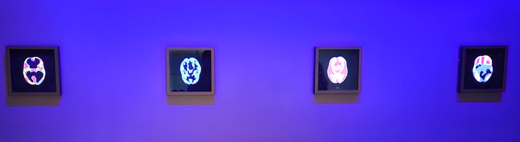 Beaded brain scans, located at an exhibit at the National Gallery of Canada. Credit to artist Ruth and Theo Cuthand.
